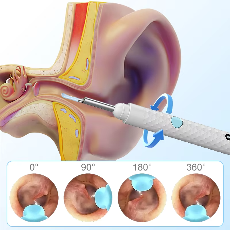 Visual Wireless Otoscope โ 4.2mm 1080P Ear Camera with Wax Tools (iOS/Android) view 2